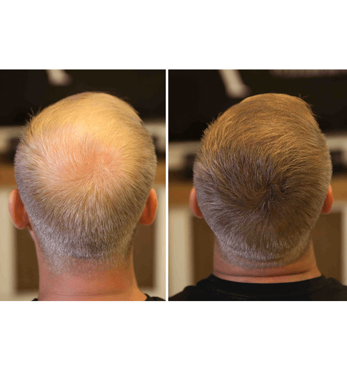 Fixplant 1 Şişe 28 Gram