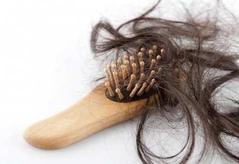 Kadınlarda Saç Dökülmesi Hakkında Bilinmesi Gerekenler